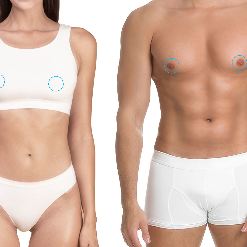 Areolas