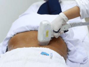 depilacion_laser_lumbar_1