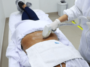 depilacion_laser_lumbar_2
