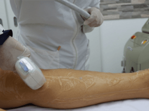 depilacion_laser_piernas_completas_3