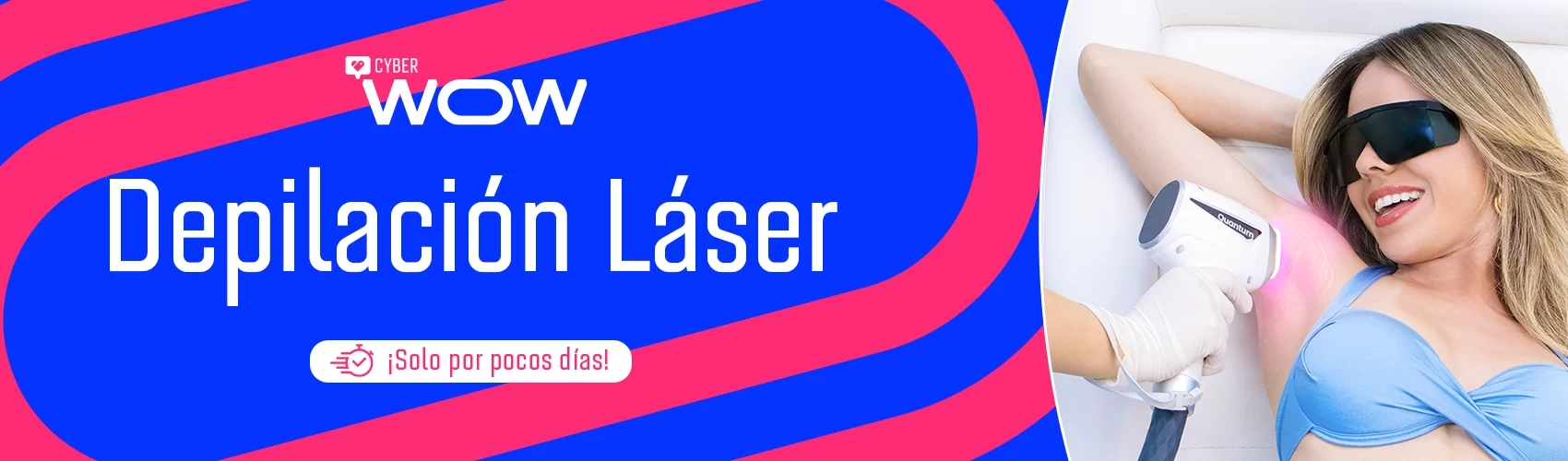 depilacion-wow